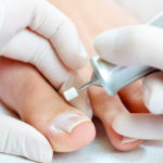 nail-restoration-treatment